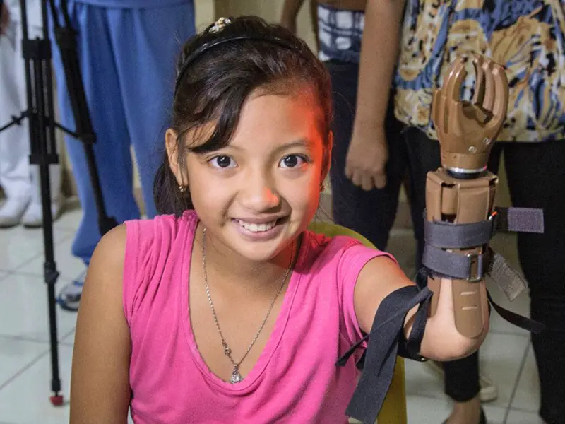 Prosthetic Hand Workshop